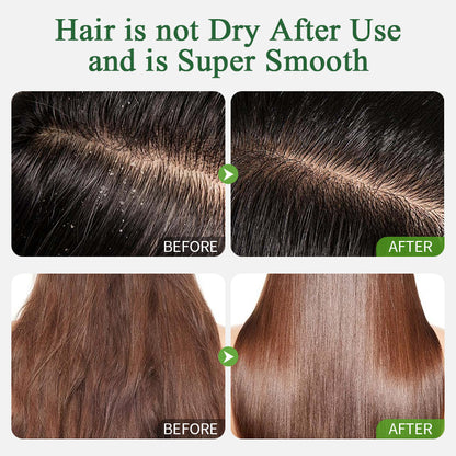 Ropink Scalp & Hair Wellness Kit